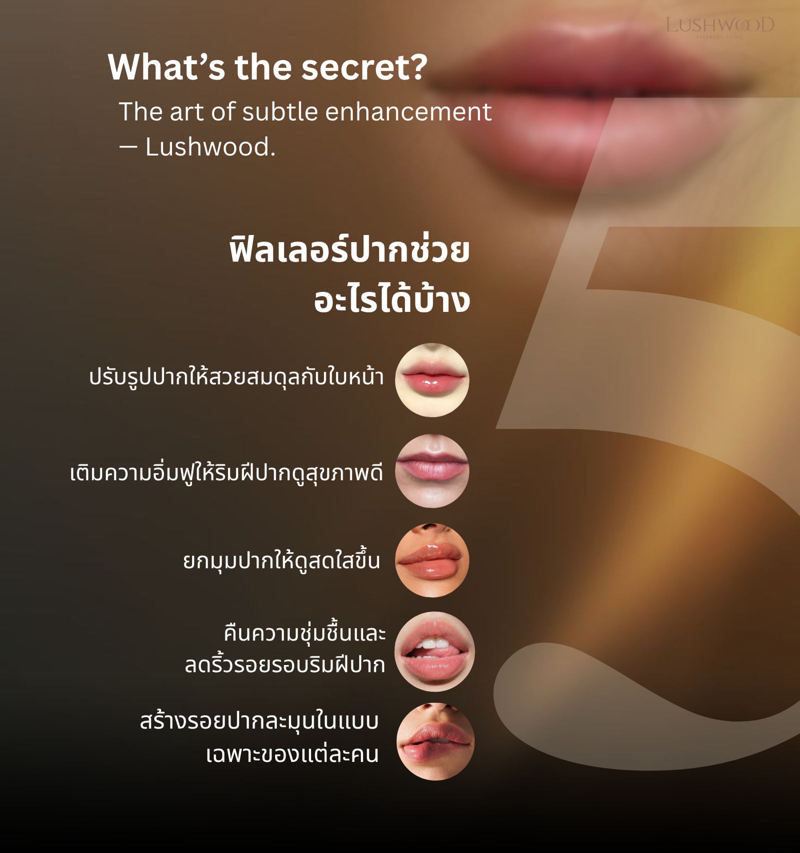 ฟิลเลอร์ปาก